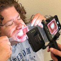 Photomed Dental LED Light for Smartphone